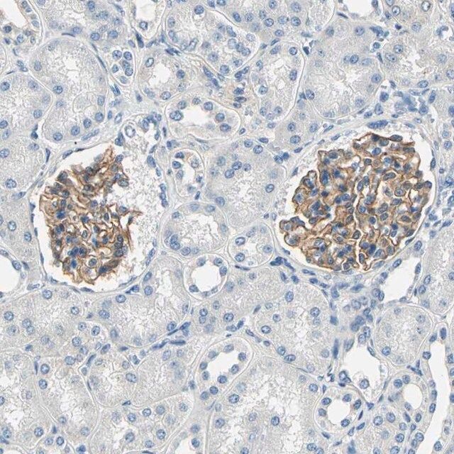 Anti-TGFBR3 antibody produced in rabbit
