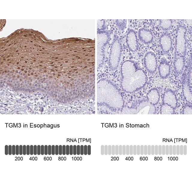 Anti-TGM3 antibody produced in rabbit