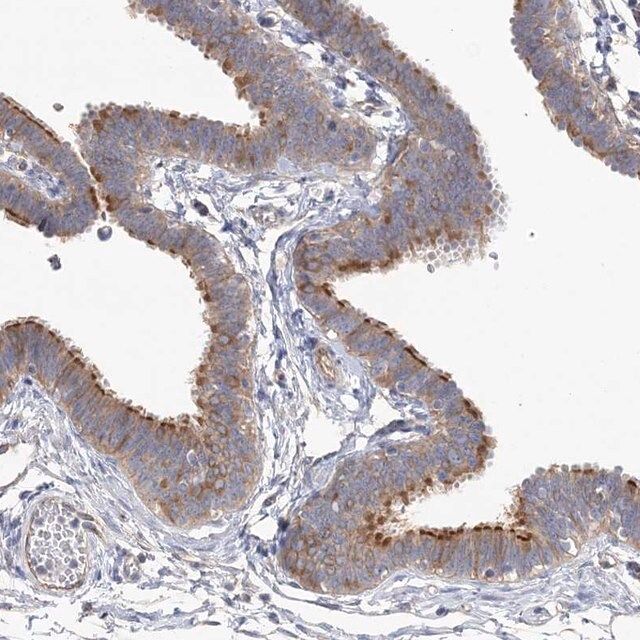 Anti-TTC21B antibody produced in rabbit