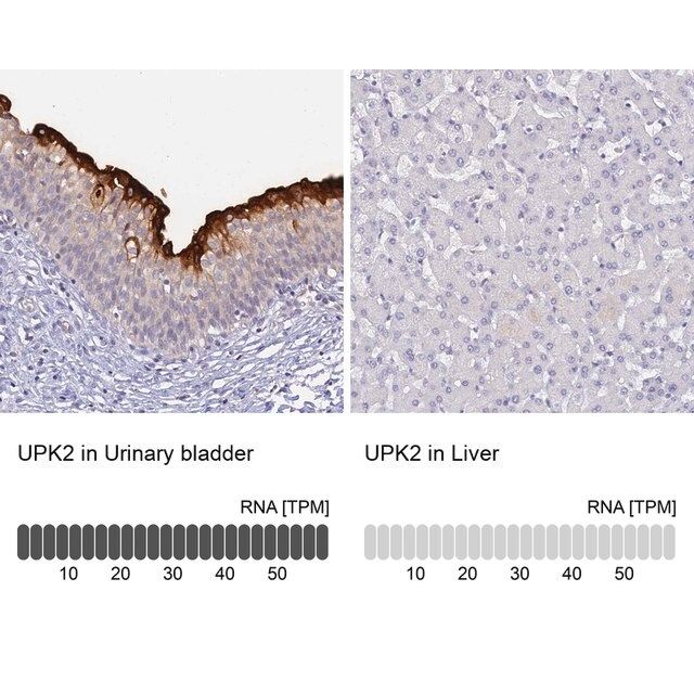 Anti-UPK2 antibody produced in rabbit