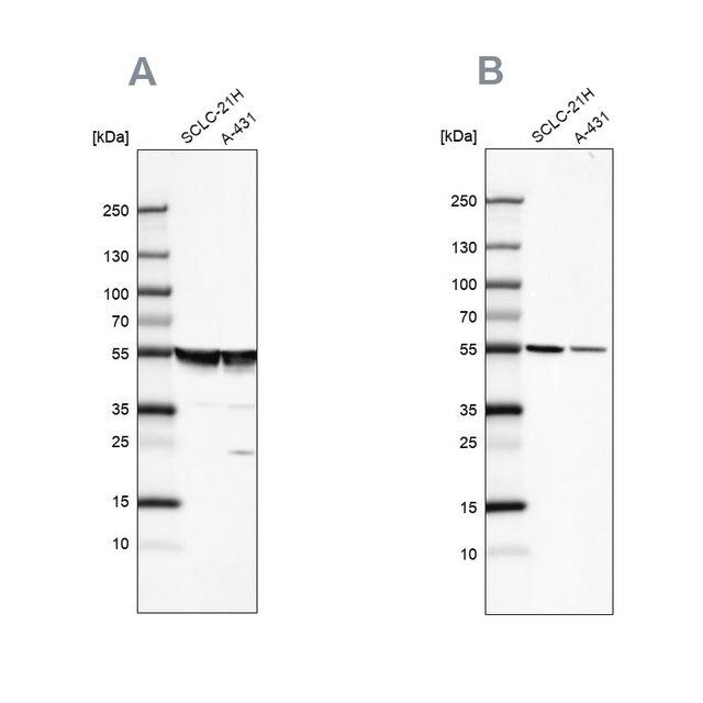 Anti-TUBA1A antibody produced in rabbit