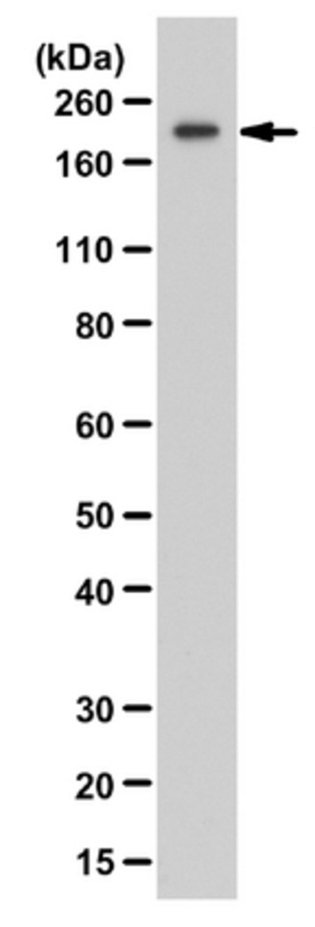 Anti-ZEB1 Antibody