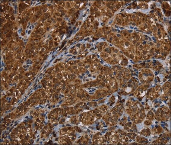 Anti-HSD17B13 antibody produced in rabbit
