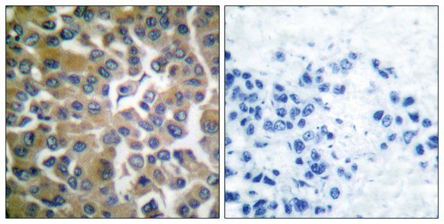 Anti-FAP-1 antibody produced in rabbit