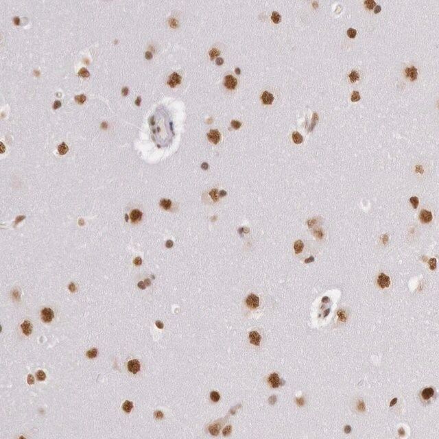 Anti-HNRNPH2 antibody produced in rabbit