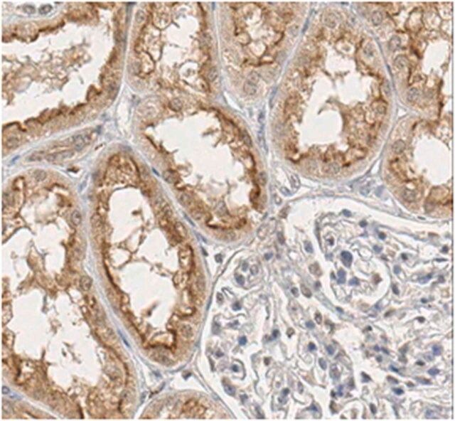 Anti-Osteoprotegerin/TNFRSF11B Antibody