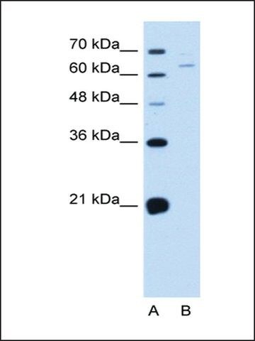 Anti-NOX1