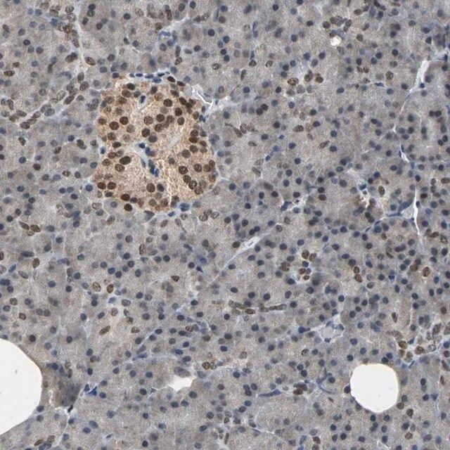 Anti-PHC1 antibody produced in rabbit