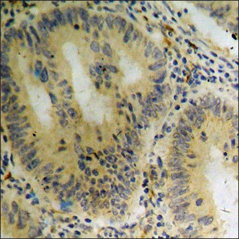 Anti-phospho-ASK1 (pSer<sup>966</sup>) antibody produced in rabbit