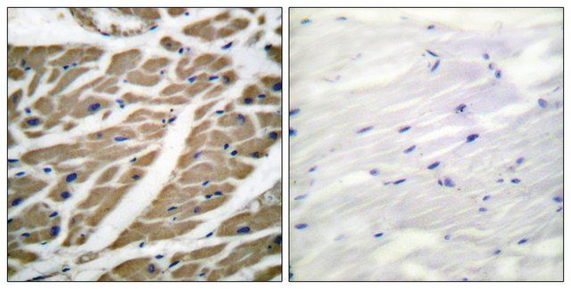 Anti-SODIUM CHANNEL-PAN antibody produced in rabbit