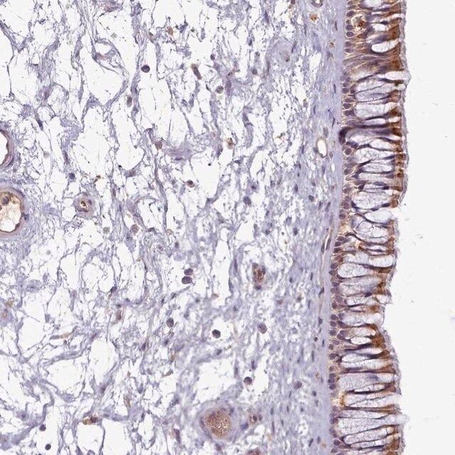 Anti-C1QTNF5 antibody produced in rabbit