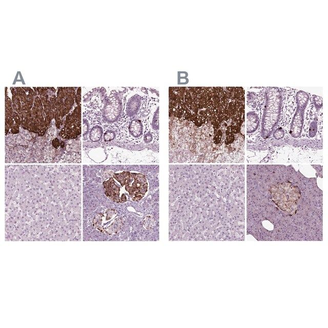 Anti-CHGB antibody produced in rabbit