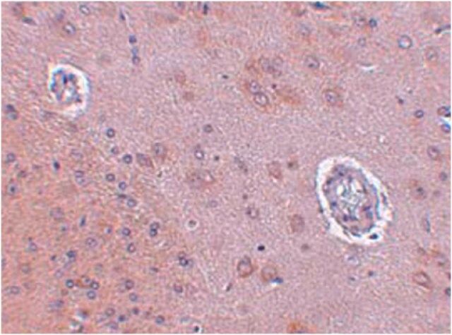 Anti-FAM120A Antibody