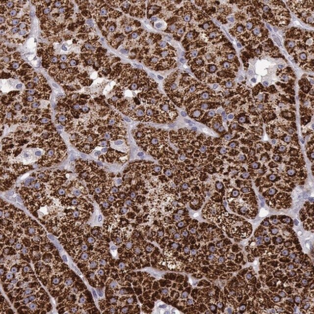 Anti-CYP11B1 antibody produced in rabbit
