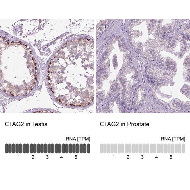 Anti-CTAG2 antibody produced in rabbit