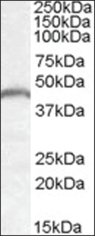 Anti-PNPLA3 antibody produced in goat