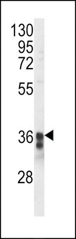 ANTI-TM173(C-TERMINAL) antibody produced in rabbit