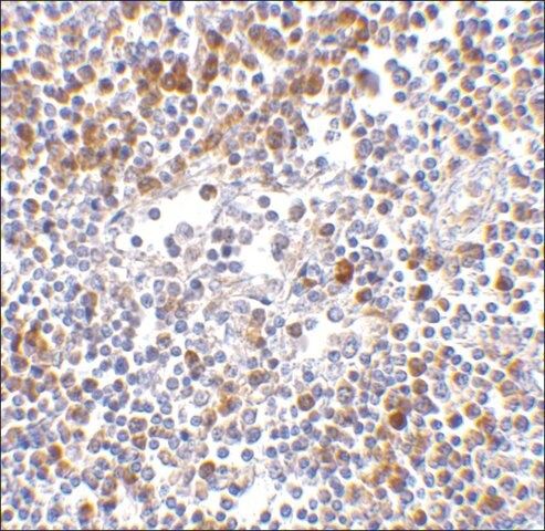 Anti-MDA5 antibody produced in rabbit