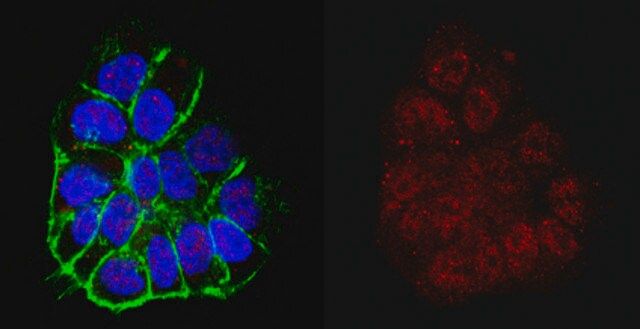 Anti-TERT Antibody