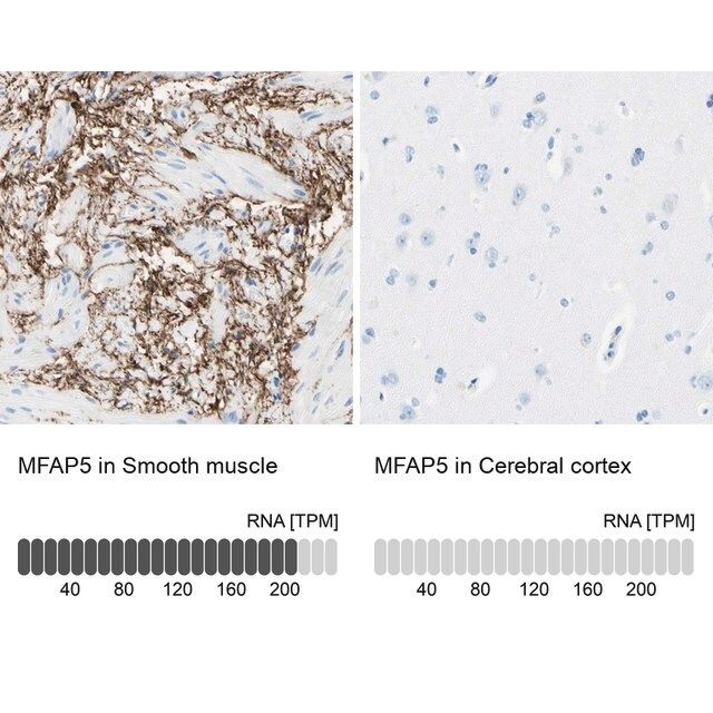 Anti-MFAP5 antibody produced in rabbit