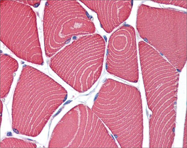 Anti-MYH7 antibody produced in rabbit