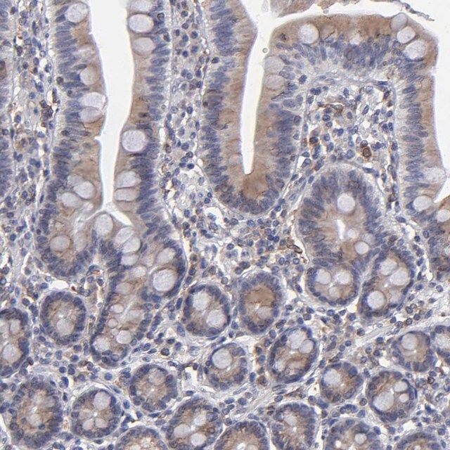 Anti-TMX1 antibody produced in rabbit