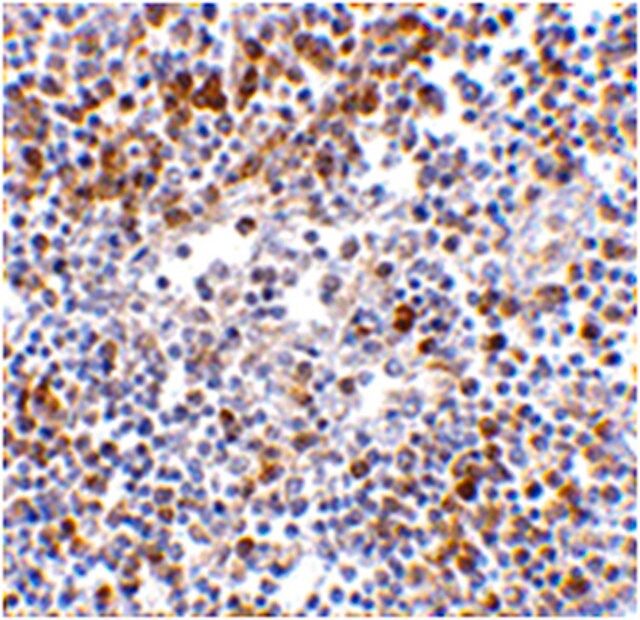 Anti-MDA5 Antibody