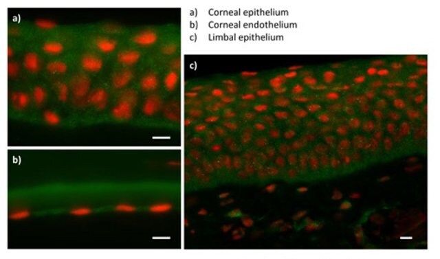 Anti-ZEB1 antibody produced in rabbit