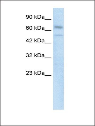 Anti-ZNF306 antibody produced in rabbit
