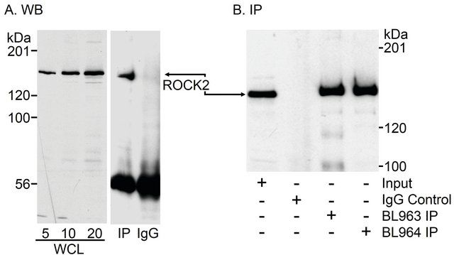 Rabbit anti-ROCK2 Antibody, Affinity Purified