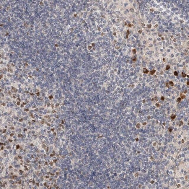 Anti-ZNF277 antibody produced in rabbit