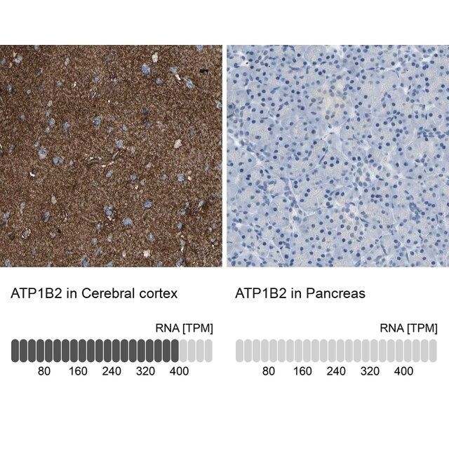 Anti-ATP1B2 antibody produced in rabbit