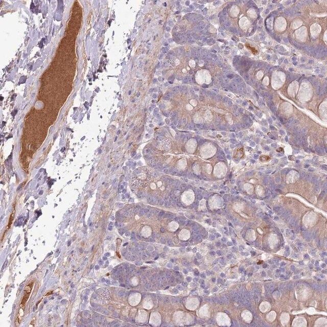 Anti-CFH antibody produced in rabbit