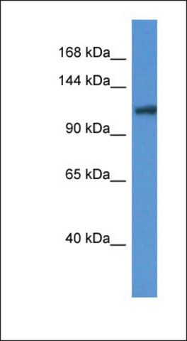 Anti-ANO6 antibody produced in rabbit