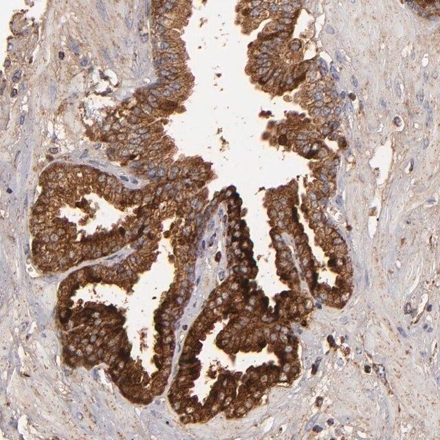 Anti-CFB antibody produced in rabbit