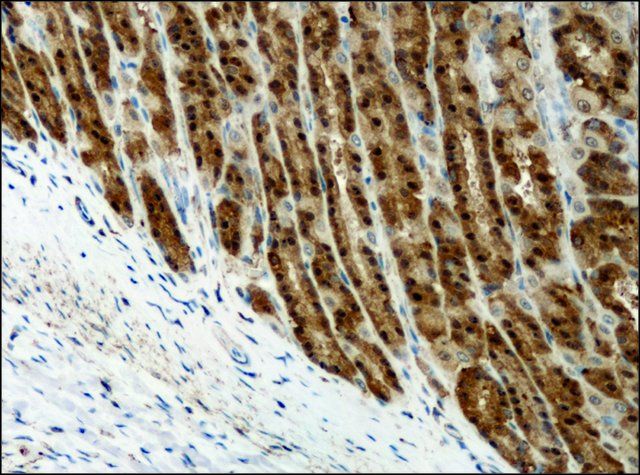 Anti-Destrin/ADF (GV-13) antibody produced in rabbit