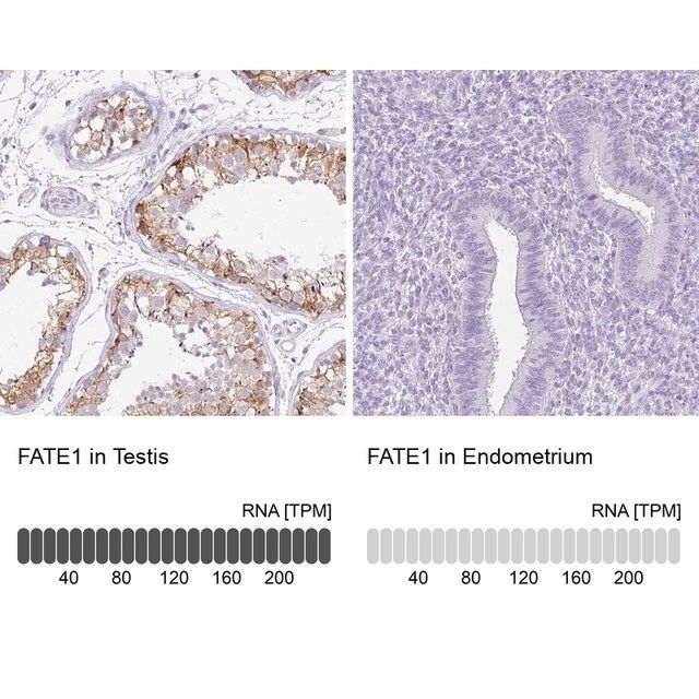 Anti-FATE1 antibody produced in rabbit