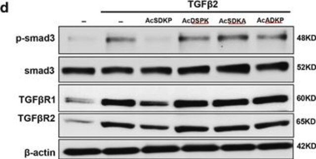 Anti-TGF β Receptor I antibody produced in rabbit