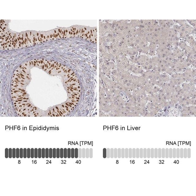 Anti-PHF6 antibody produced in rabbit
