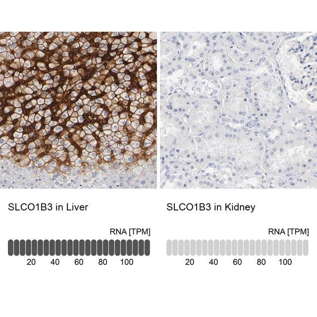 Anti-SLCO1B3 antibody produced in rabbit