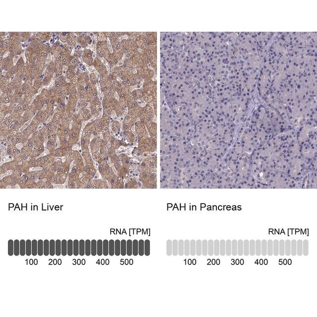 Anti-PAH antibody produced in rabbit