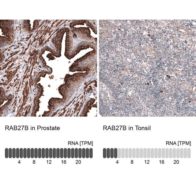 Anti-RAB27B antibody produced in rabbit