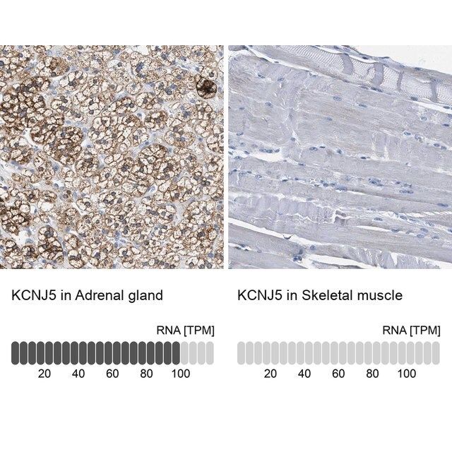 Anti-KCNJ5 antibody produced in rabbit