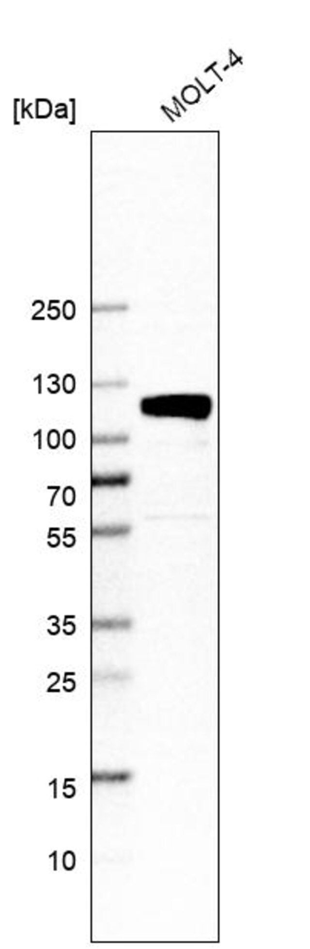 Anti-QRICH1 antibody produced in rabbit
