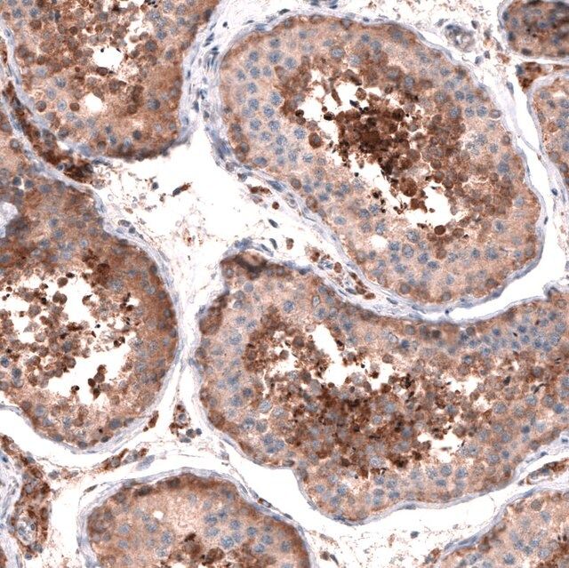 Anti-OSBP2 antibody produced in rabbit