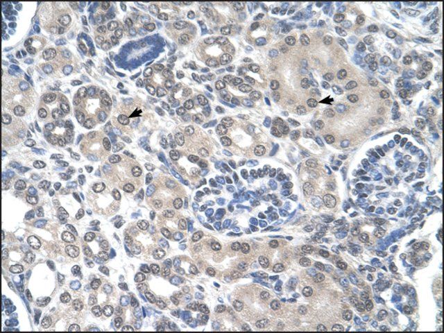 Anti-PPAT antibody produced in rabbit