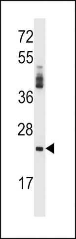 ANTI-PRSS2 (CENTER) antibody produced in rabbit