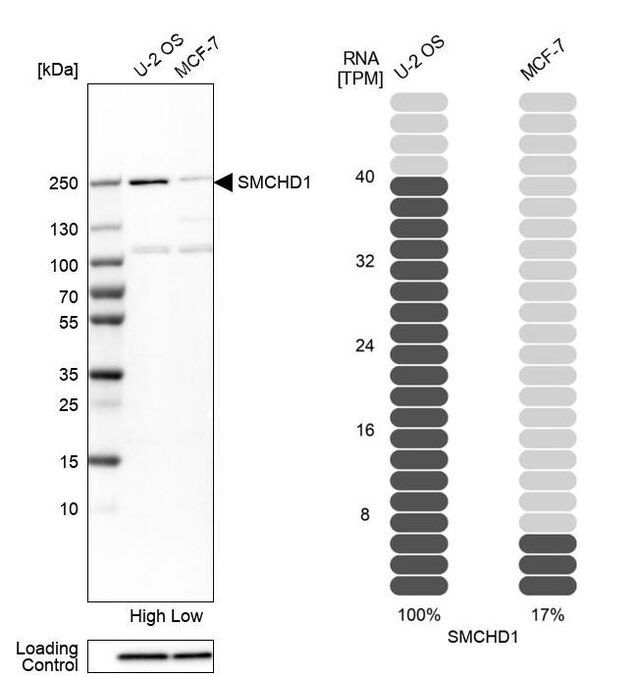 Anti-SMCHD1 antibody produced in rabbit