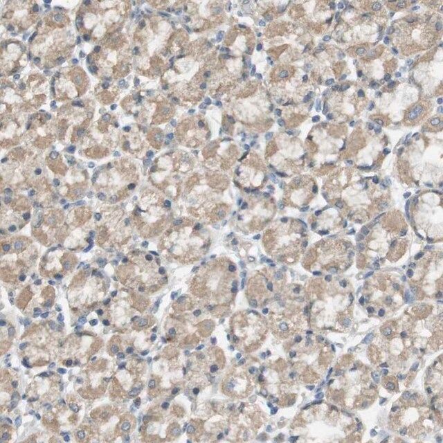 Anti-ZDHHC20 antibody produced in rabbit