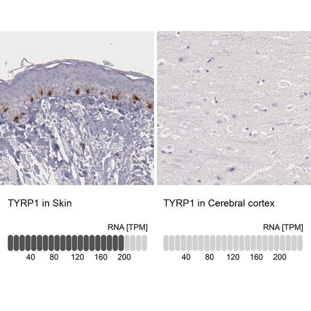 Anti-TYRP1 antibody produced in rabbit